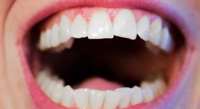 healthy gums with teeth